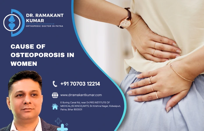 Cause of Osteoporosis in Women