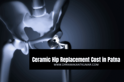 Ceramic Hip Replacement Cost in Patna