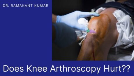 Does Knee Arthroscopy Hurt