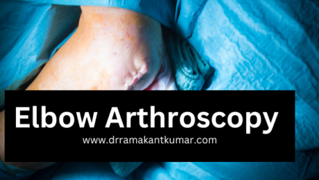 Tips for Elbow Arthroscopy Surgery
