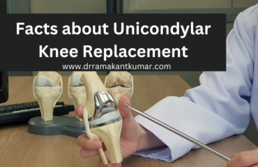 Facts about Unicondylar Knee Replacement