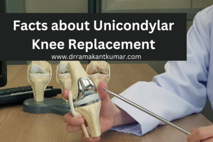 Facts about Unicondylar Knee Replacement