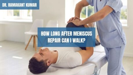How Long After Meniscus Repair Can I Walk