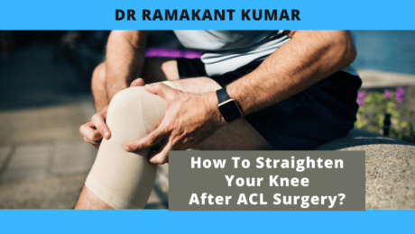 How To Straighten Your Knee After ACL Surgery