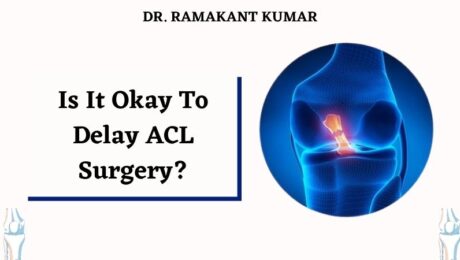 Is It Okay To Delay ACL Surgery