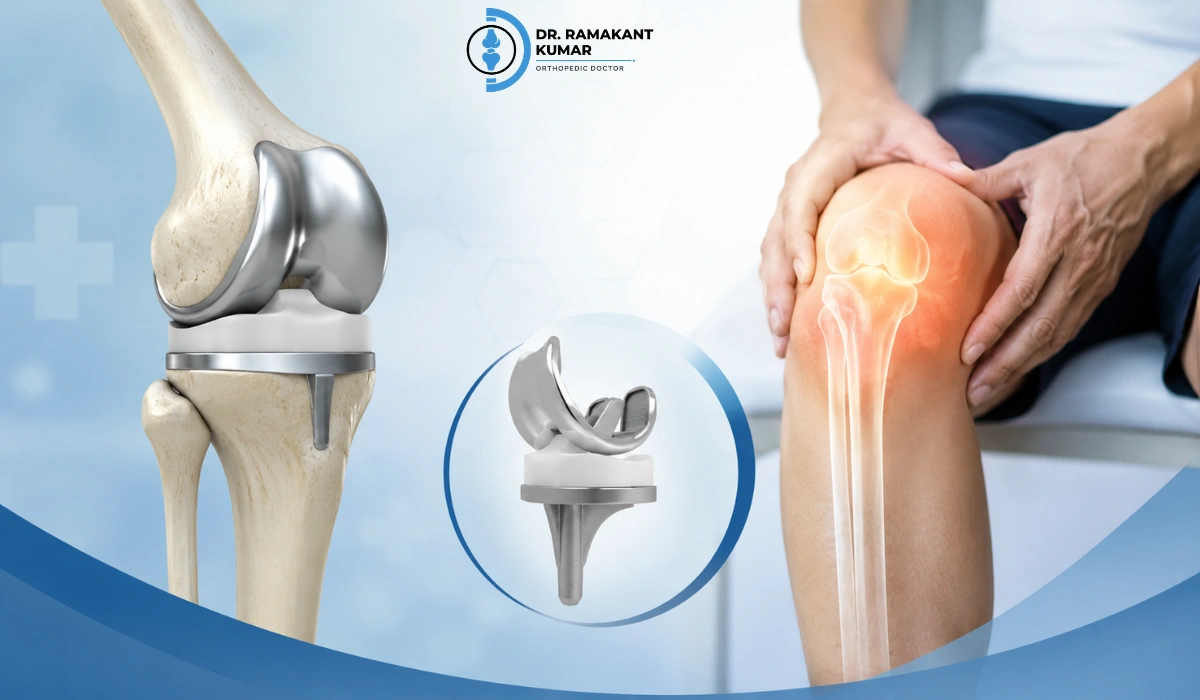 Is Joint Replacement the Right Choice for You? Signs, Options, Risks and Recovery