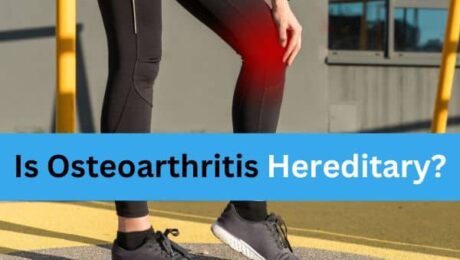 Is Osteoarthritis Hereditary