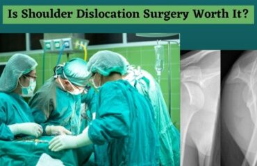 Is Shoulder Dislocation Surgery Worth It