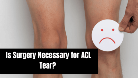 Is Surgery Necessary for ACL Tear