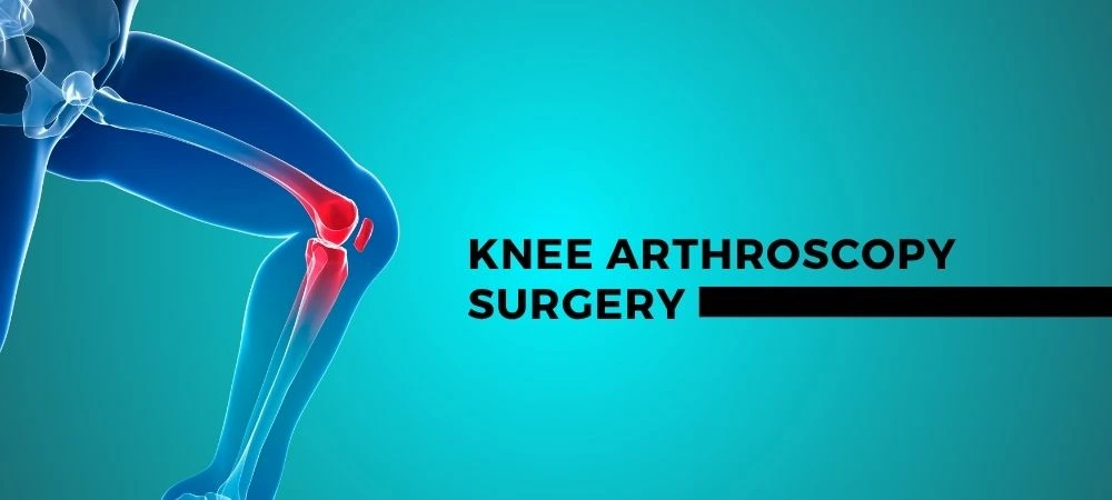 Knee Arthroscopy doctor in Patna