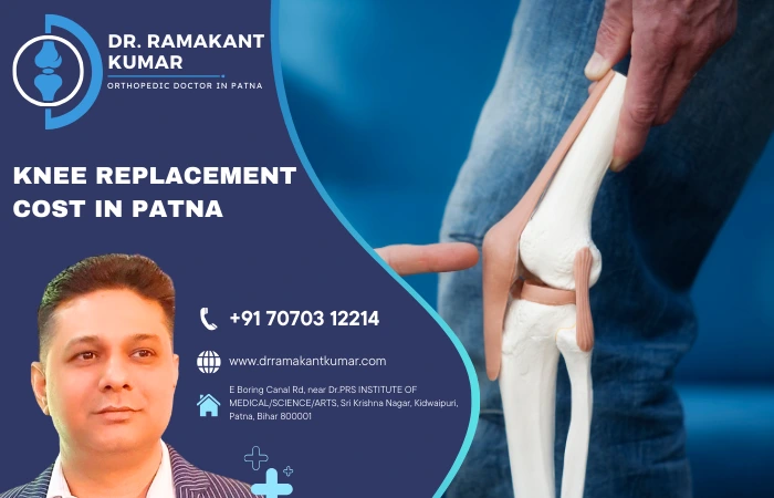 Knee Replacement Surgery Cost in Patna