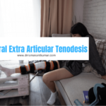 Lateral Extra Articular Tenodesis