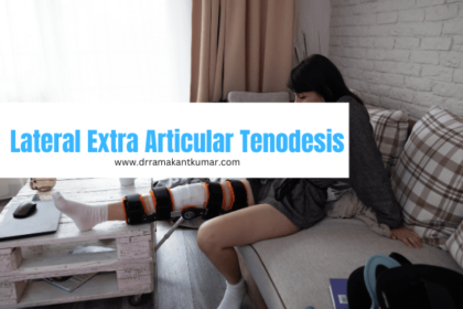 Lateral Extra Articular Tenodesis