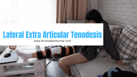 Lateral Extra Articular Tenodesis