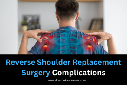 Reverse Shoulder Replacement Surgery Complications