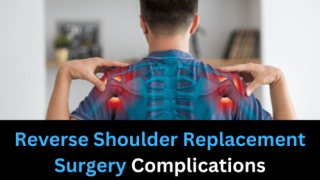 Reverse Shoulder Replacement Surgery Complications