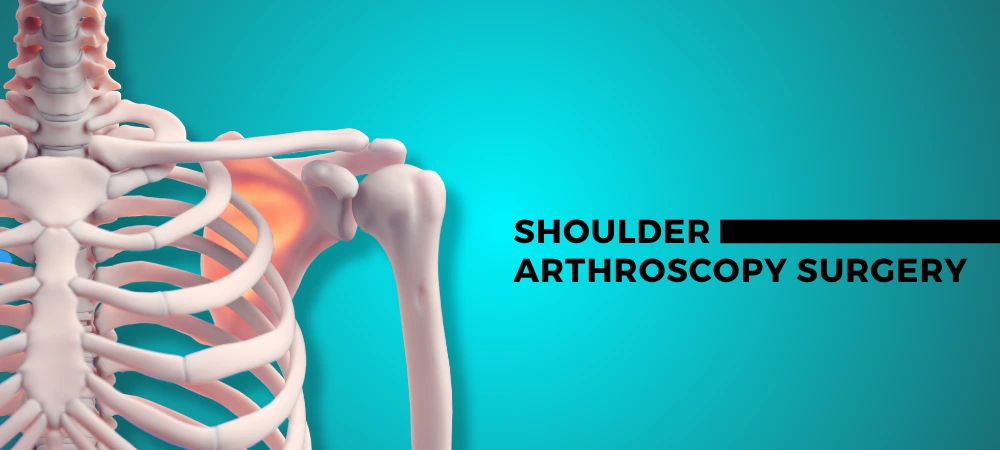 Shoulder Arthroscopy Surgery