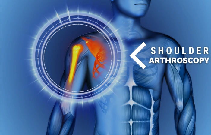 Shoulder Arthroscopy in Patna