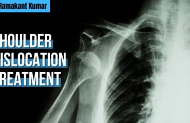 Shoulder Dislocation Treatment