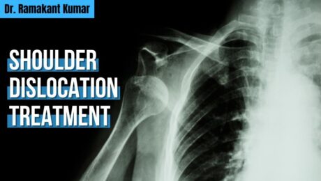 Shoulder Dislocation Treatment