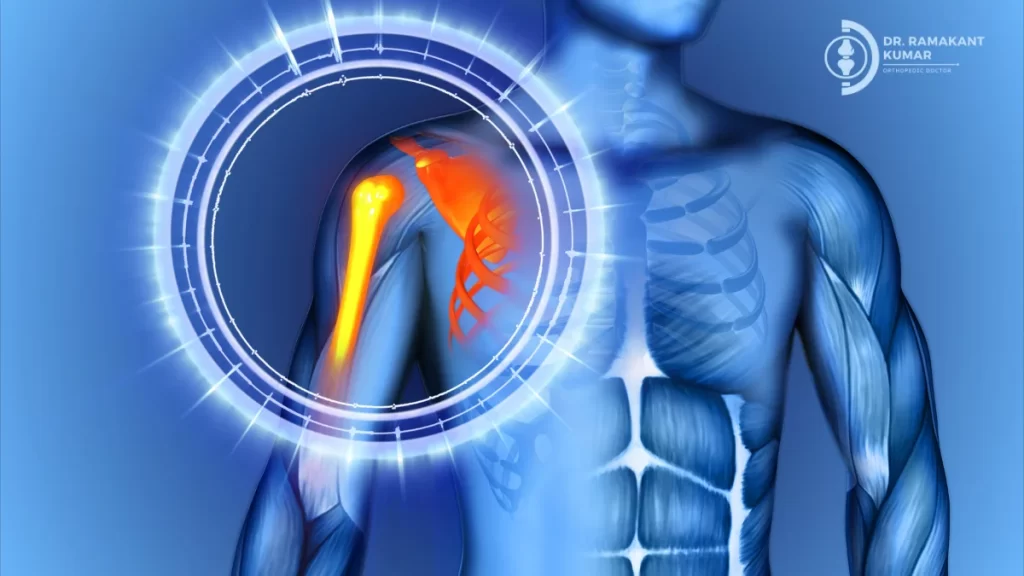 Shoulder Pain at Night: Why It Happens and How to Sleep Without Pain