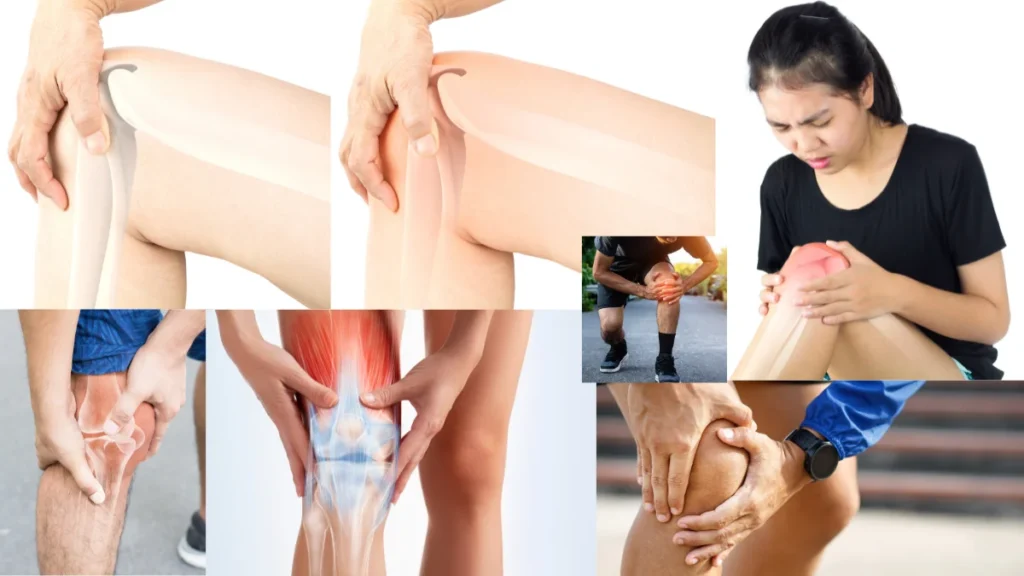 Signs of a Chipped Bone You Should Not Ignore