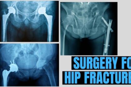 Surgery for Hip Fractures