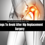 Things To Avoid After Hip Replacement Surgery