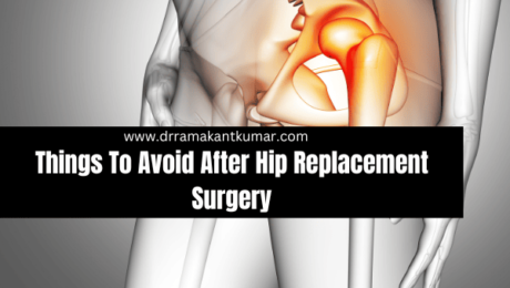 Things To Avoid After Hip Replacement Surgery