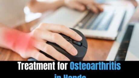 Treatment for Osteoarthritis in Hands