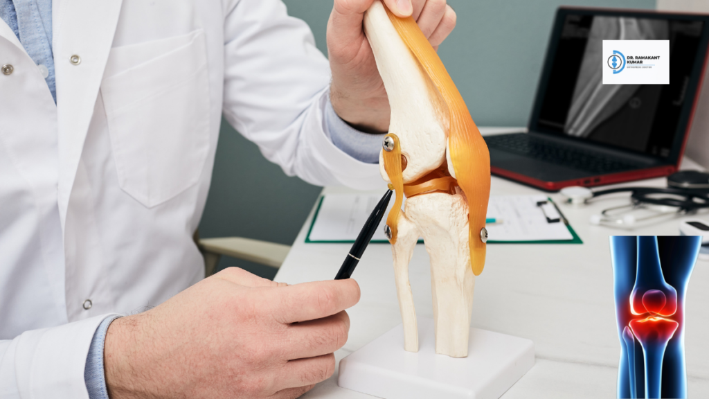 What Exactly Is an MCL Tear?