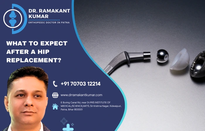 What to Expect After a Hip Replacement