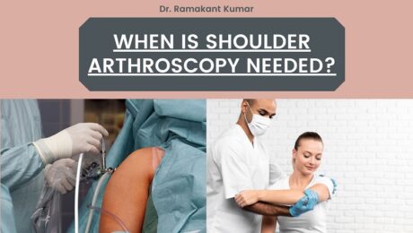 When is Shoulder Arthroscopy Needed