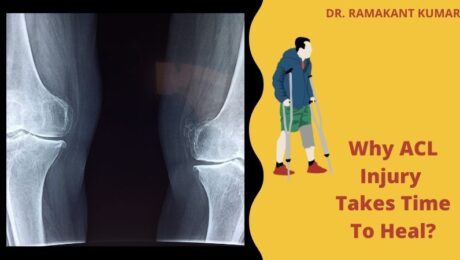 Why ACL Injury Takes Time To Heal