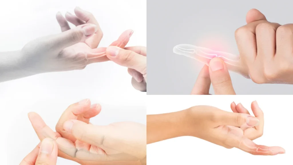 Why Chipped Bones Get Missed So Often