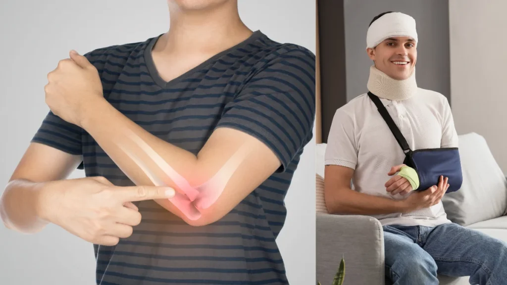 Why Treatment Differs: The Practical Types of Fractures (Patient-Friendly)