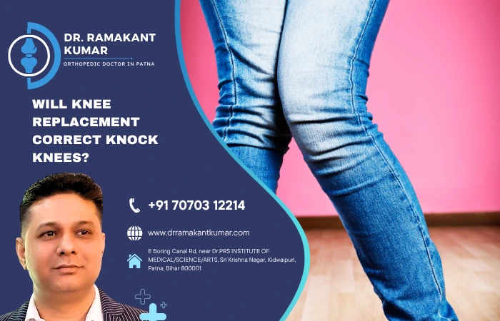 Will knee replacement correct knock knees