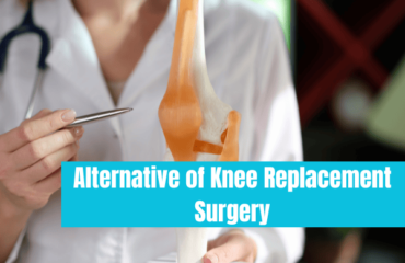 Alternative of Knee Replacement Surgery