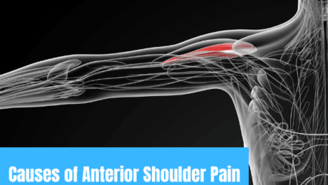 Causes of Anterior Shoulder Pain