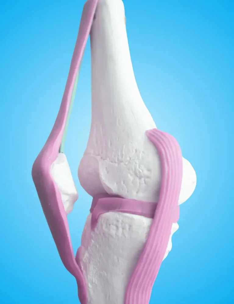 best ACL ligament surgery in Patna