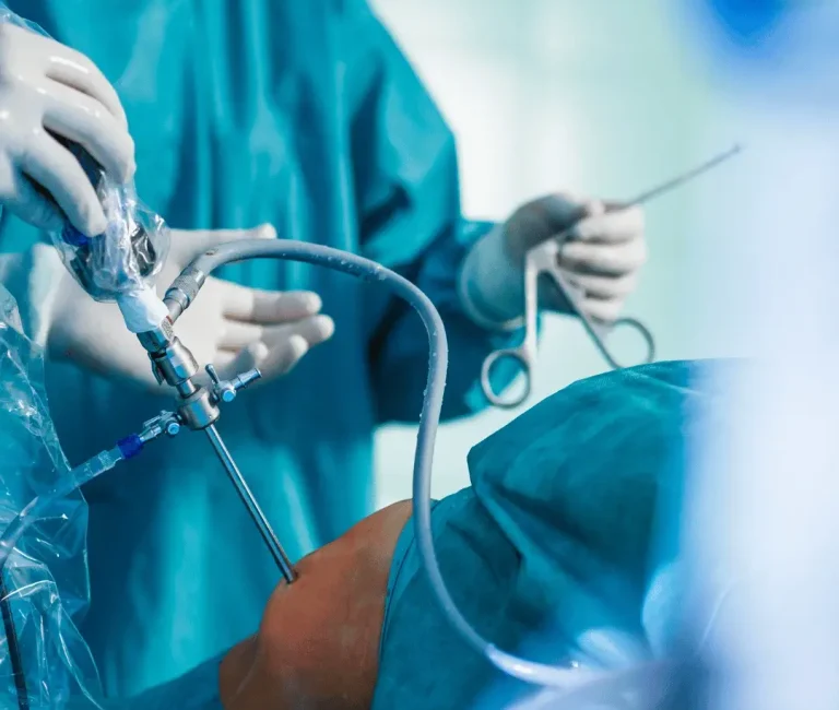 best ACL surgery in Patna