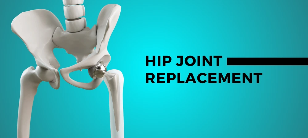hip joint replacement