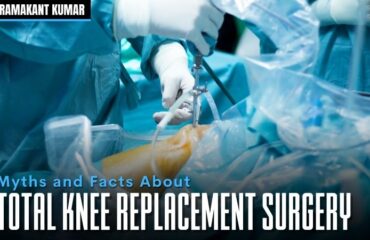 Myths and Facts About Knee Replacement Surgery
