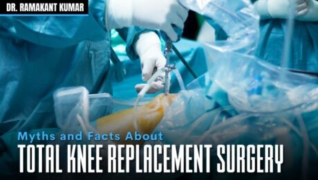 Myths and Facts About Knee Replacement Surgery