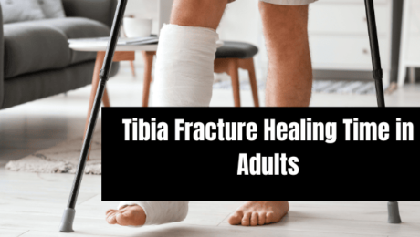 Tibia Fracture Healing Time in Adults
