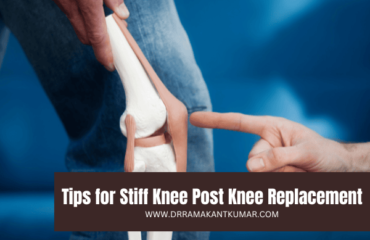 Tips for Stiff Knee Post Knee Replacement