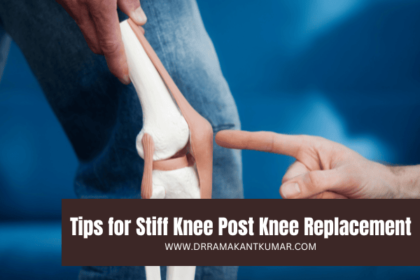 Tips for Stiff Knee Post Knee Replacement