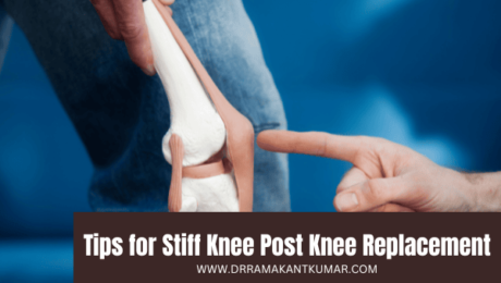 Tips for Stiff Knee Post Knee Replacement