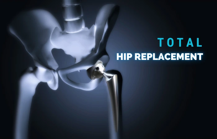 total hip replacement in Patna